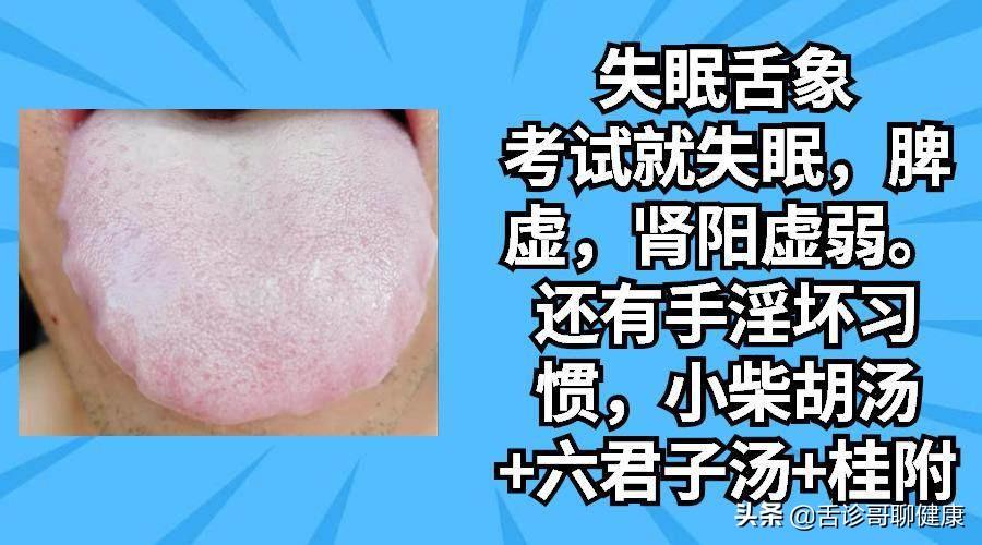 推薦 第5頁(yè)