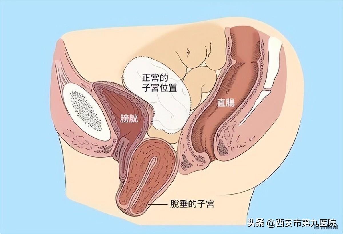 睪丸下垂松弛的原因及治療方法，睪丸下垂松弛的原因與治療方法解析