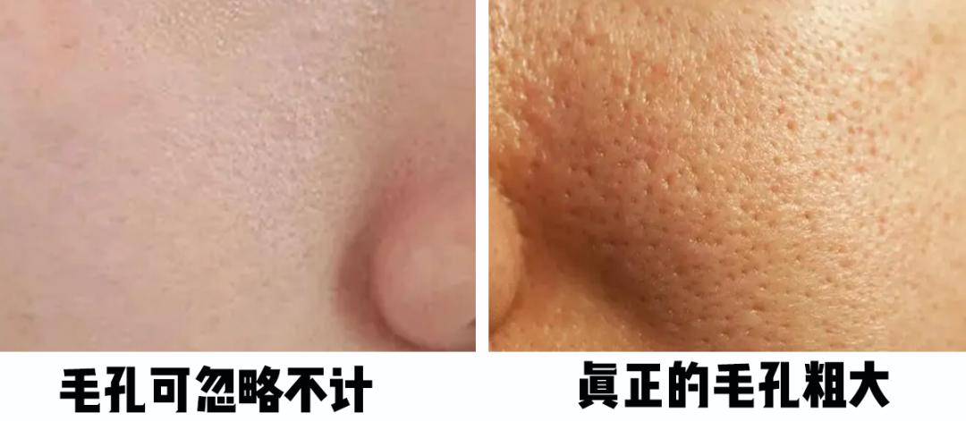 怎樣毛孔可以慢慢縮小，護(hù)膚秘籍與實(shí)用建議，護(hù)膚秘籍，縮小毛孔實(shí)用建議與指南