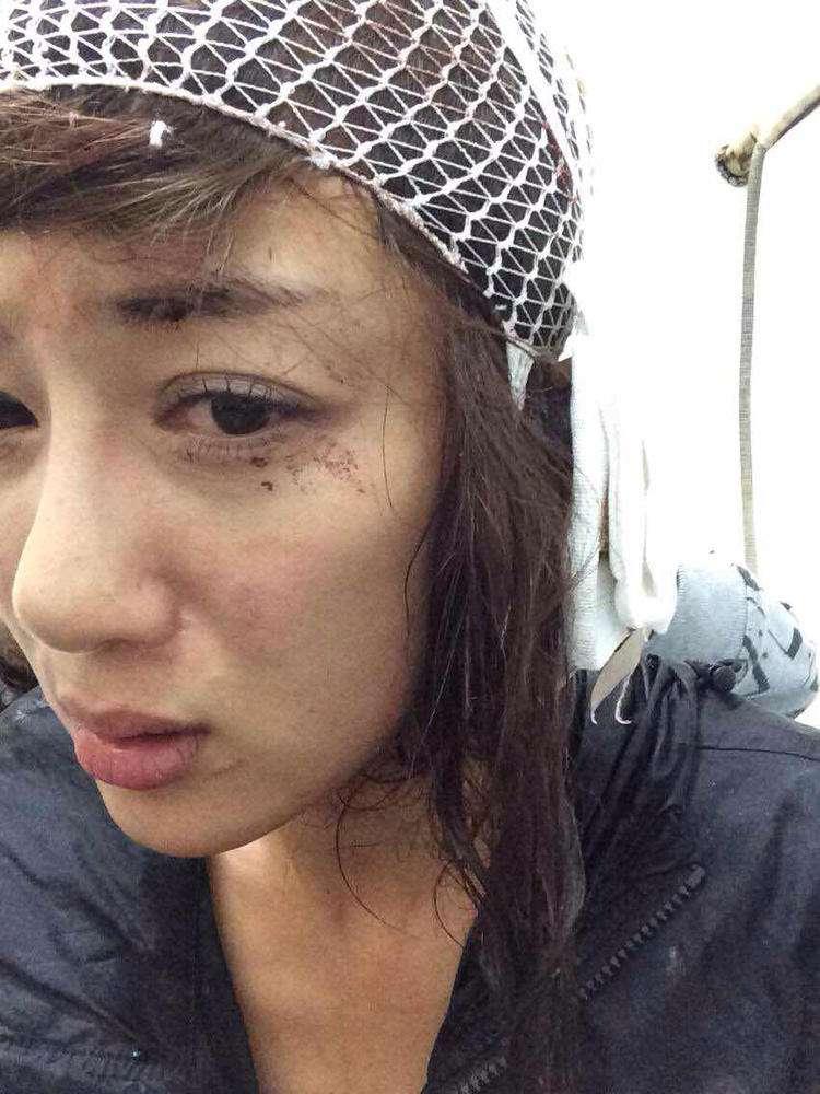 明星整容毀容最嚴(yán)重的是誰，深度探討與反思，深度探討與反思，哪位明星整容遭遇最慘重的毀容？