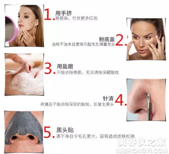 去黑頭的簡單小妙招，去黑頭小妙招分享，輕松告別黑頭困擾