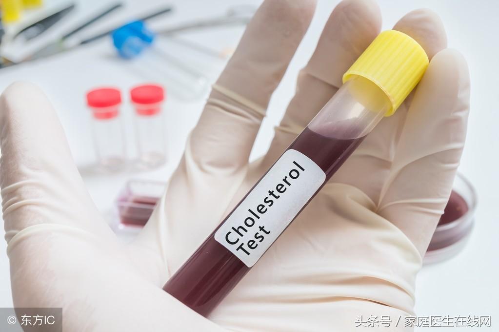 糖尿病的成因，深度解析其背后的原因，深度解析糖尿病成因，揭示背后原因真相